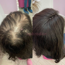 Top Closure Aphrodite - Liso