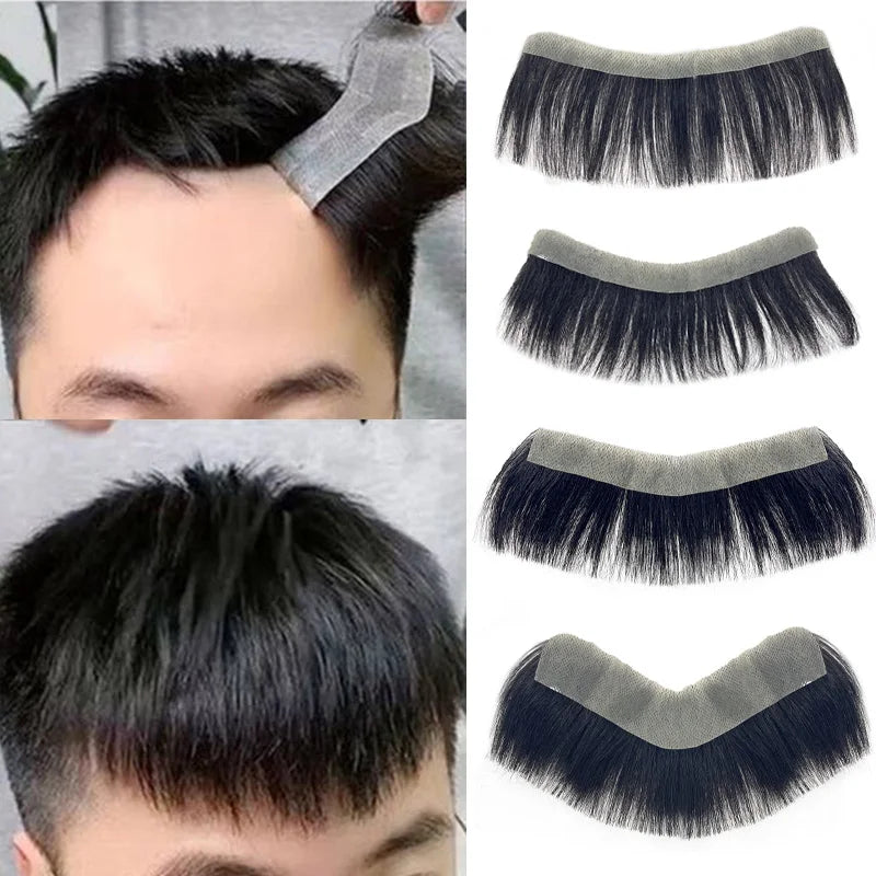 Aplique frontal Masculino - 100% humano